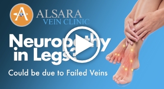 Neuropathy in Legs